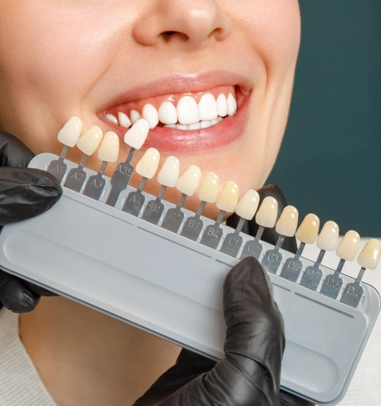 Dental professional holding tooth shade guide next to patient's smile for color matching.