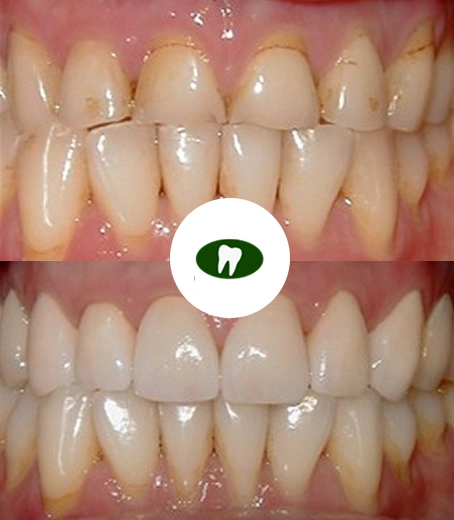 Real smile transformation by Tucson dentists